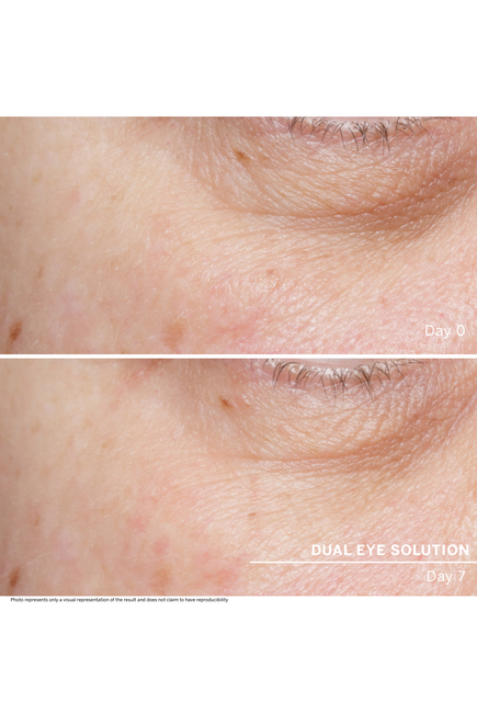 Lifting Cellular Dual Eye Solution