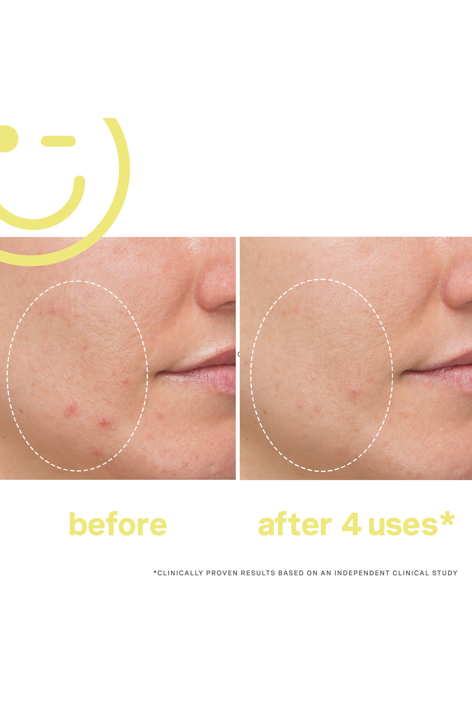 MEGA-C™ 30% Vitamin C Brightening Facial