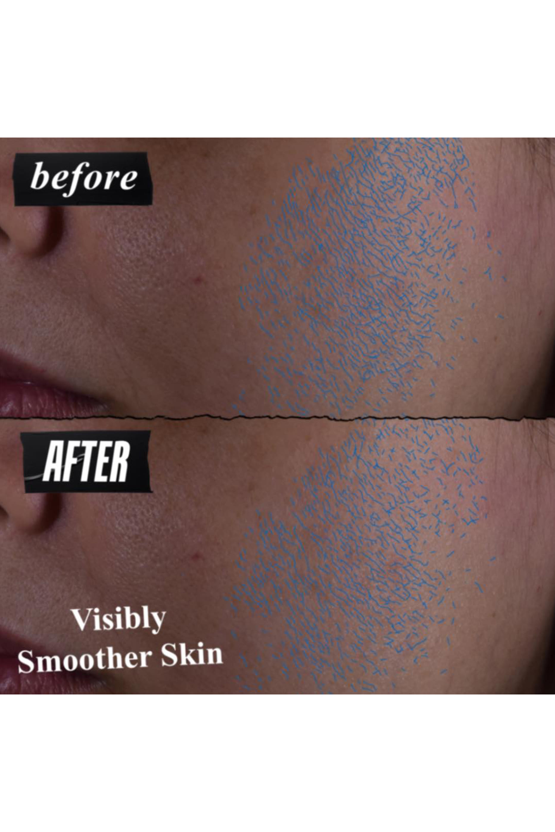 Clearly Corrective&trade; Daily Re-Texturizing Triple Acid Peel Serum