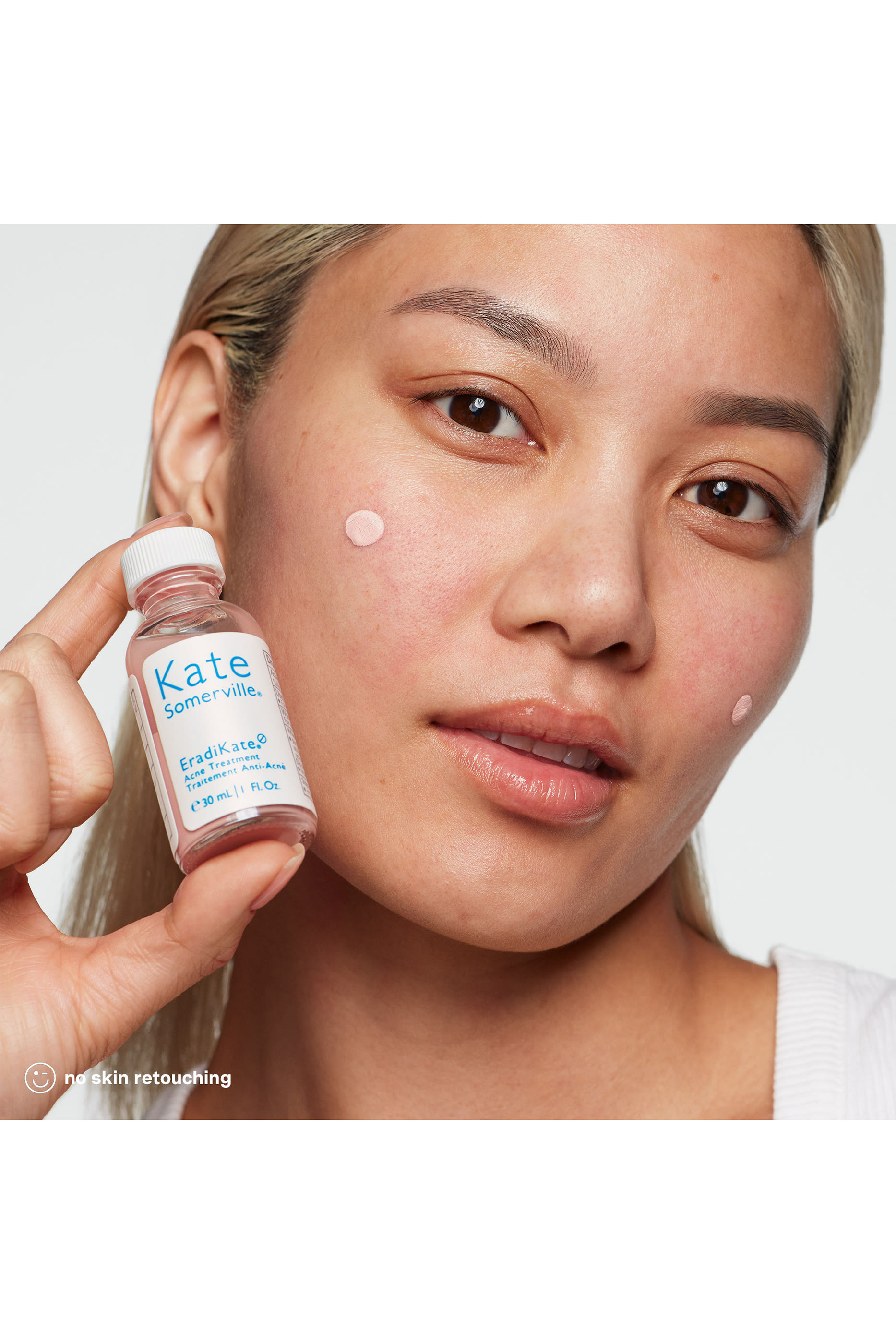 EradiKate&reg; 10% Sulfur Acne Treatment