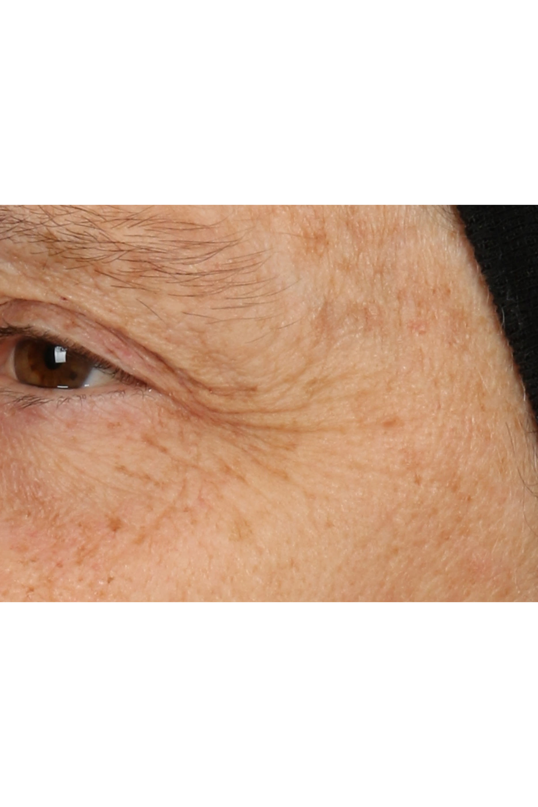 Smart Clinical Repair™ Overnight Recovery Cream + Mask