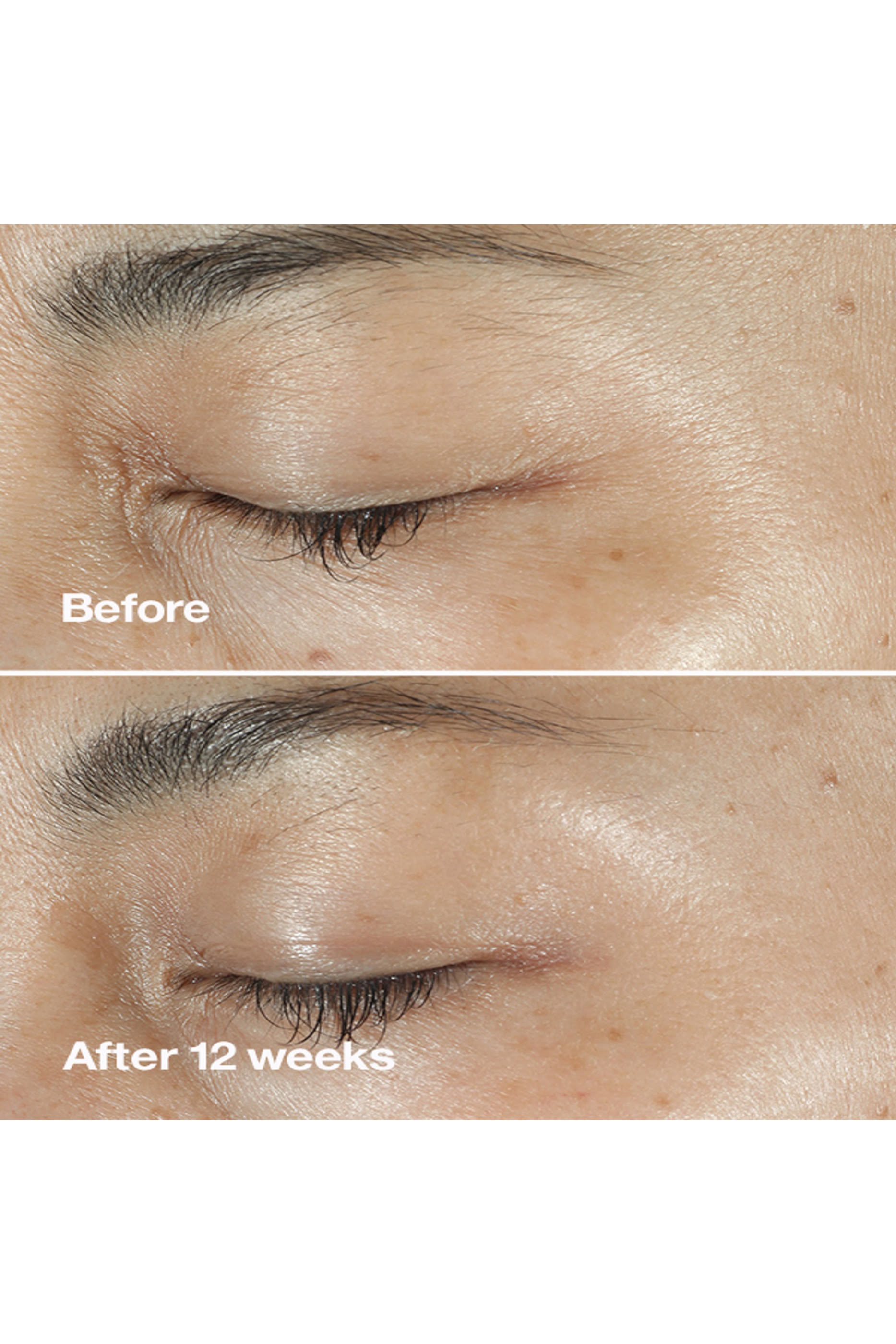 Smart Clinical Repair™ Wrinkle Correcting Serum