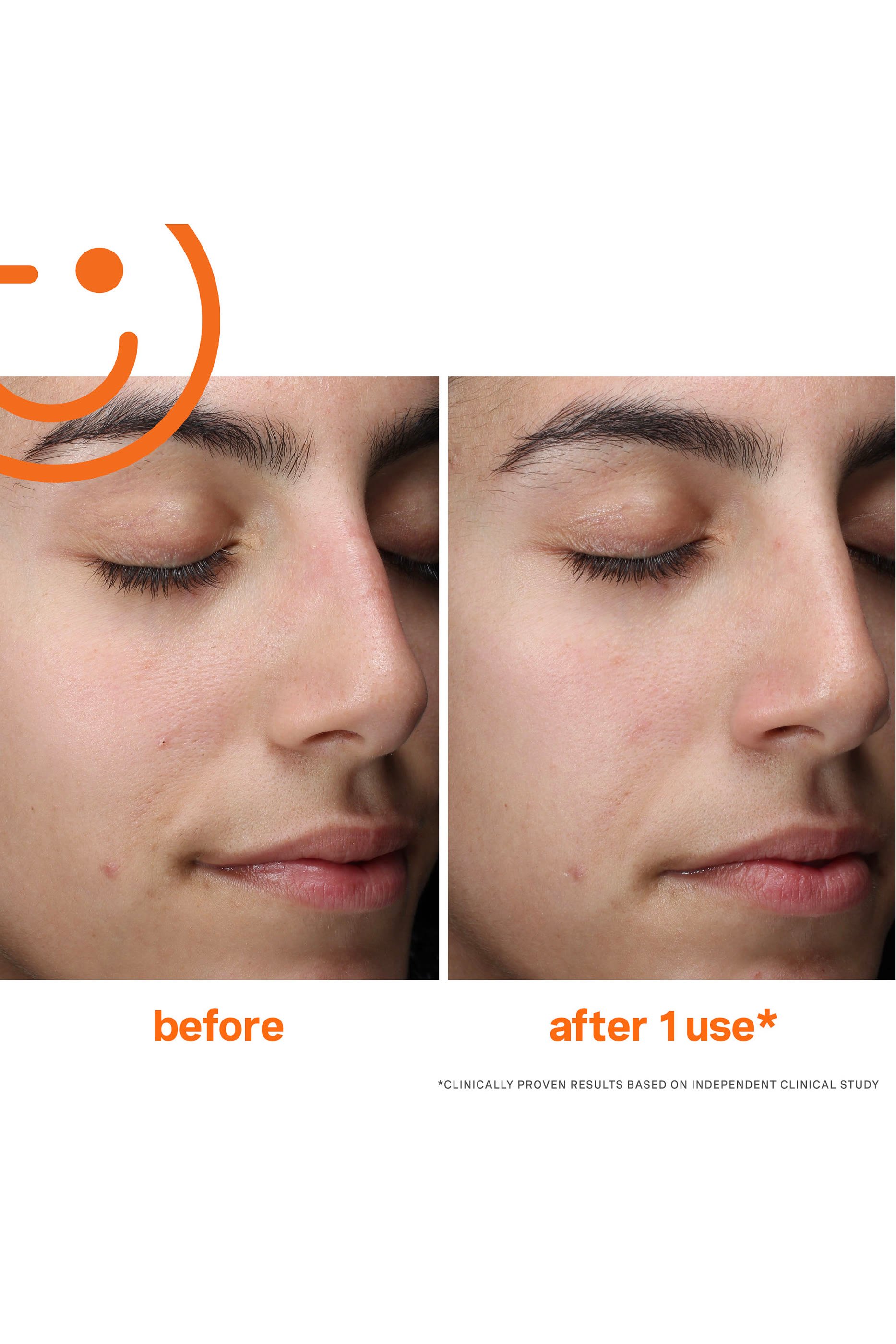 ExfoliKate® Cleanser Daily Foaming Wash