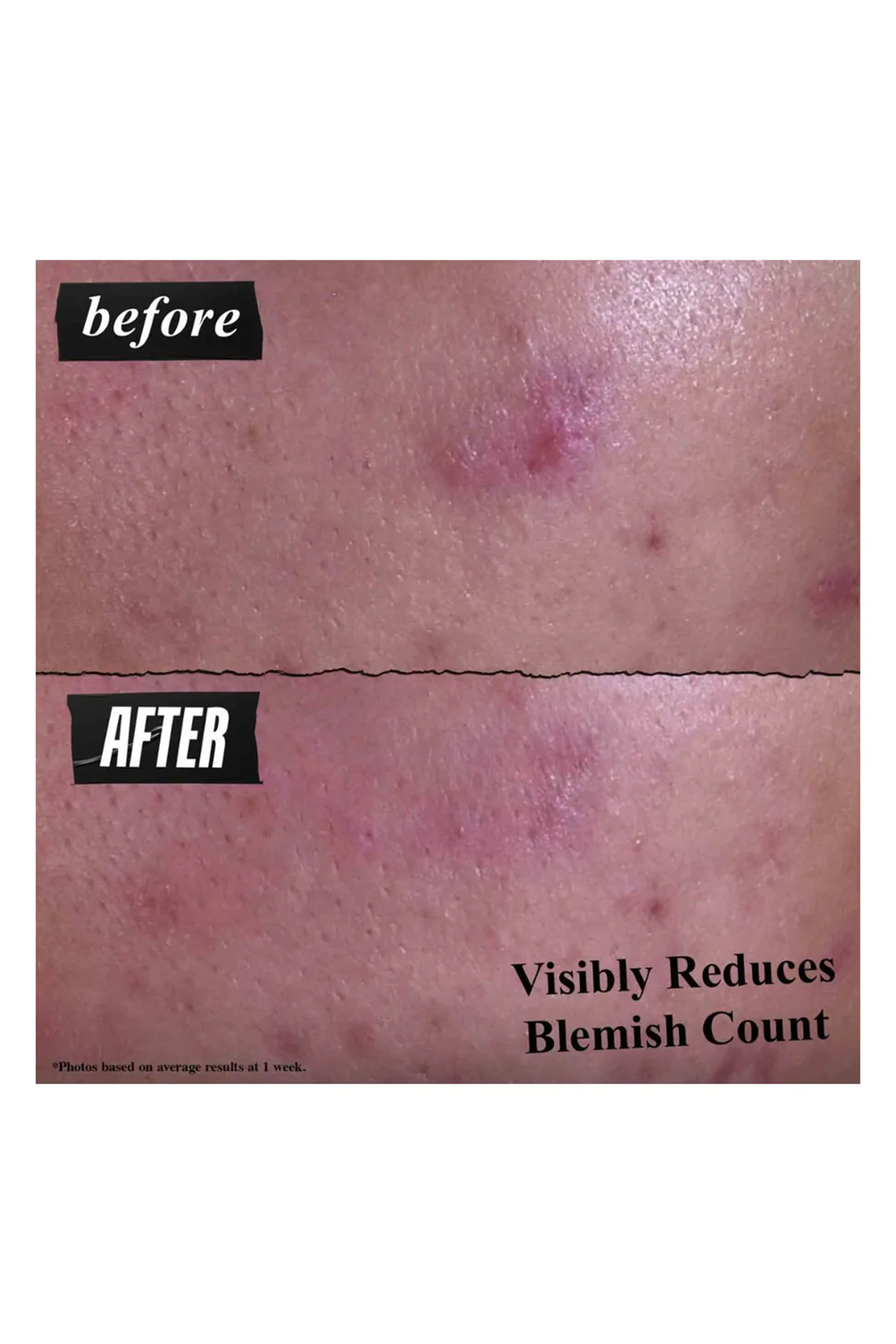 Gently Effective Blemish-Targeting Cleansing Paste