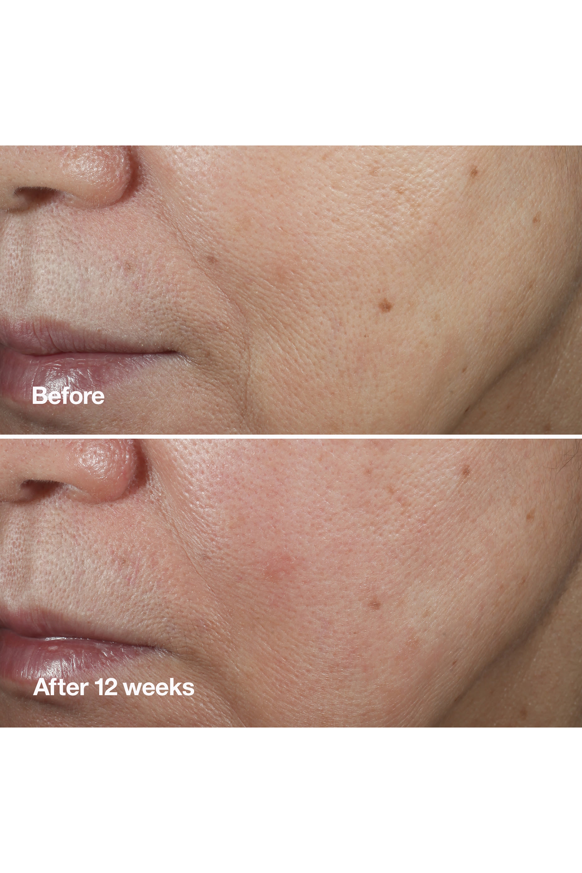 Smart Clinical Repair™ Wrinkle Correcting Serum