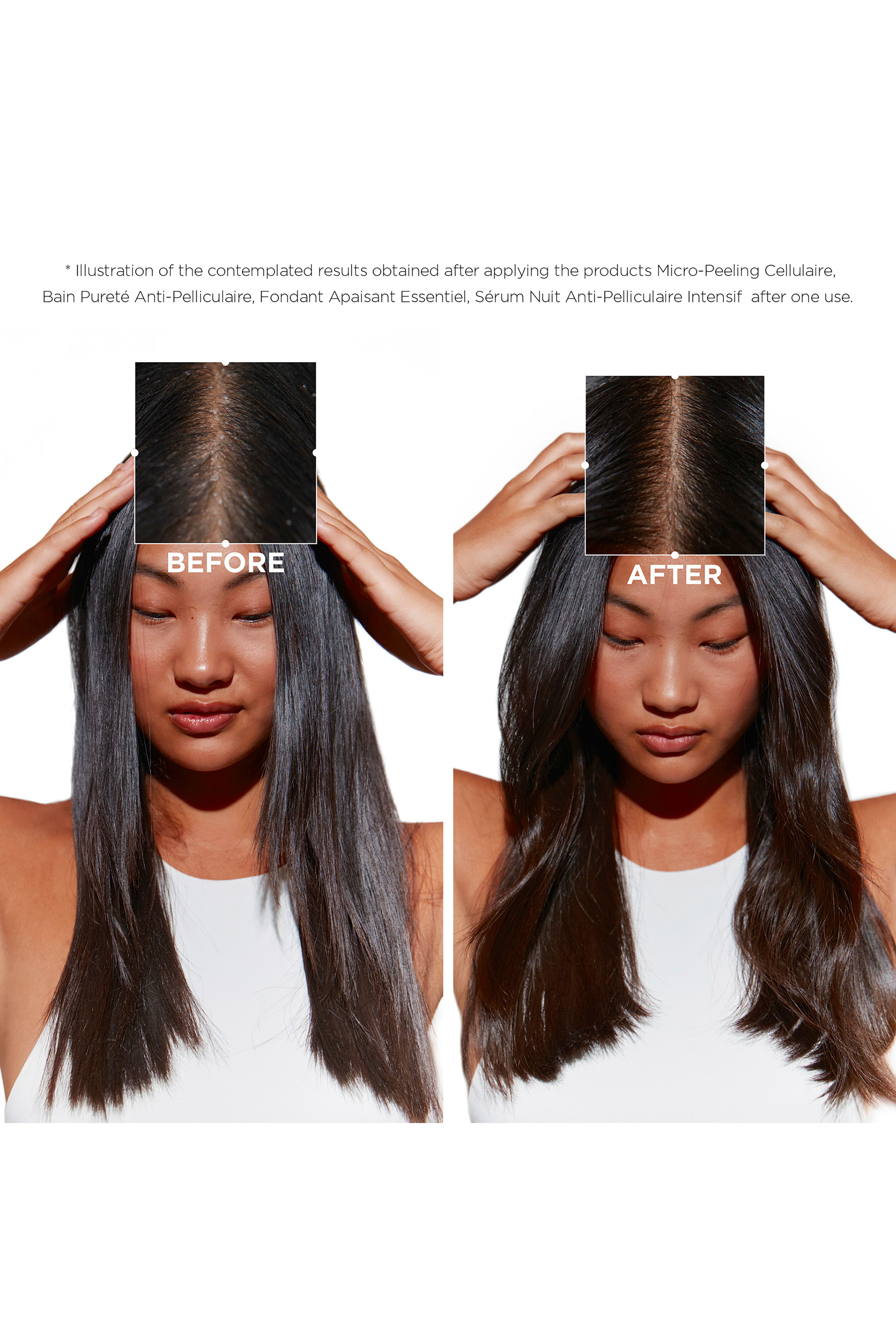 Symbiose Intensive Anti-Dandruff Night Serum