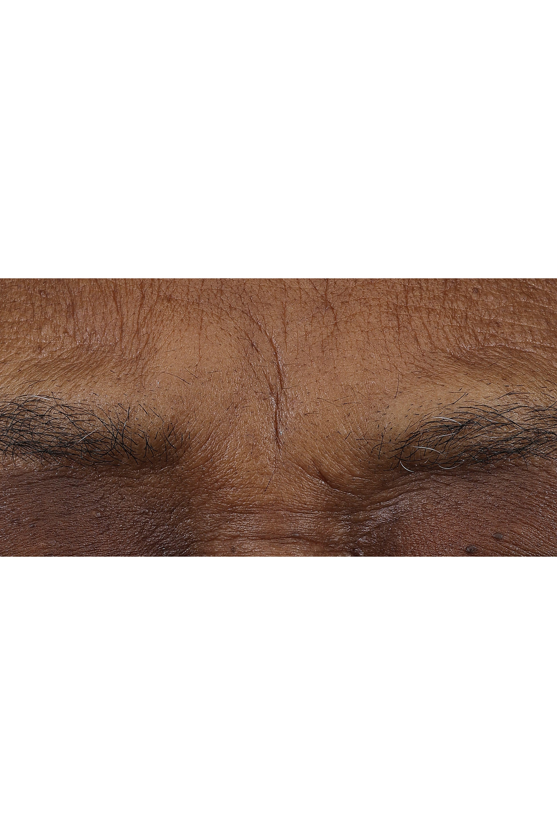 Smart Clinical Repair™ AM/PM Retinoid Balm