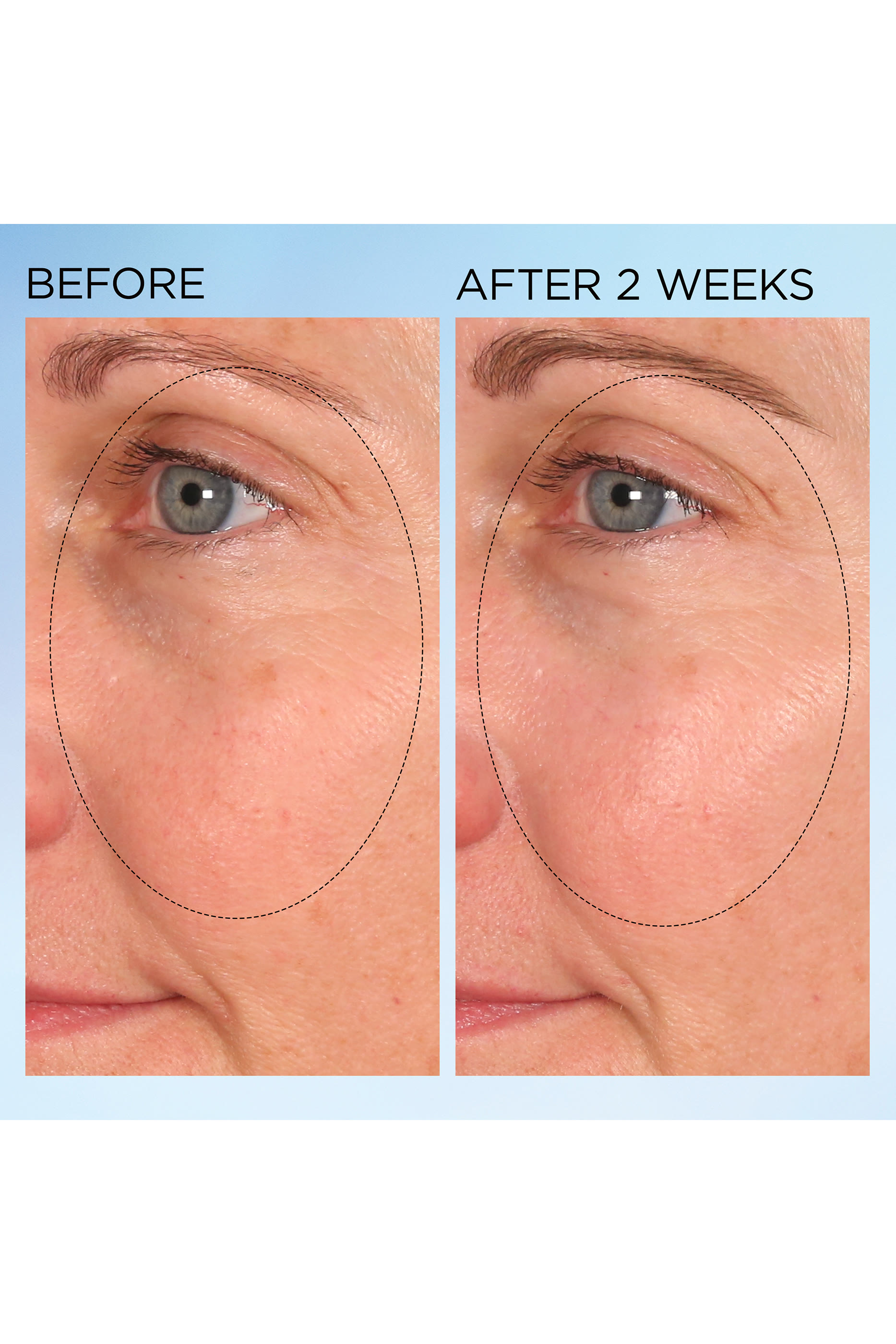  Visible Brightening Clearly Radiant Spot Correcting