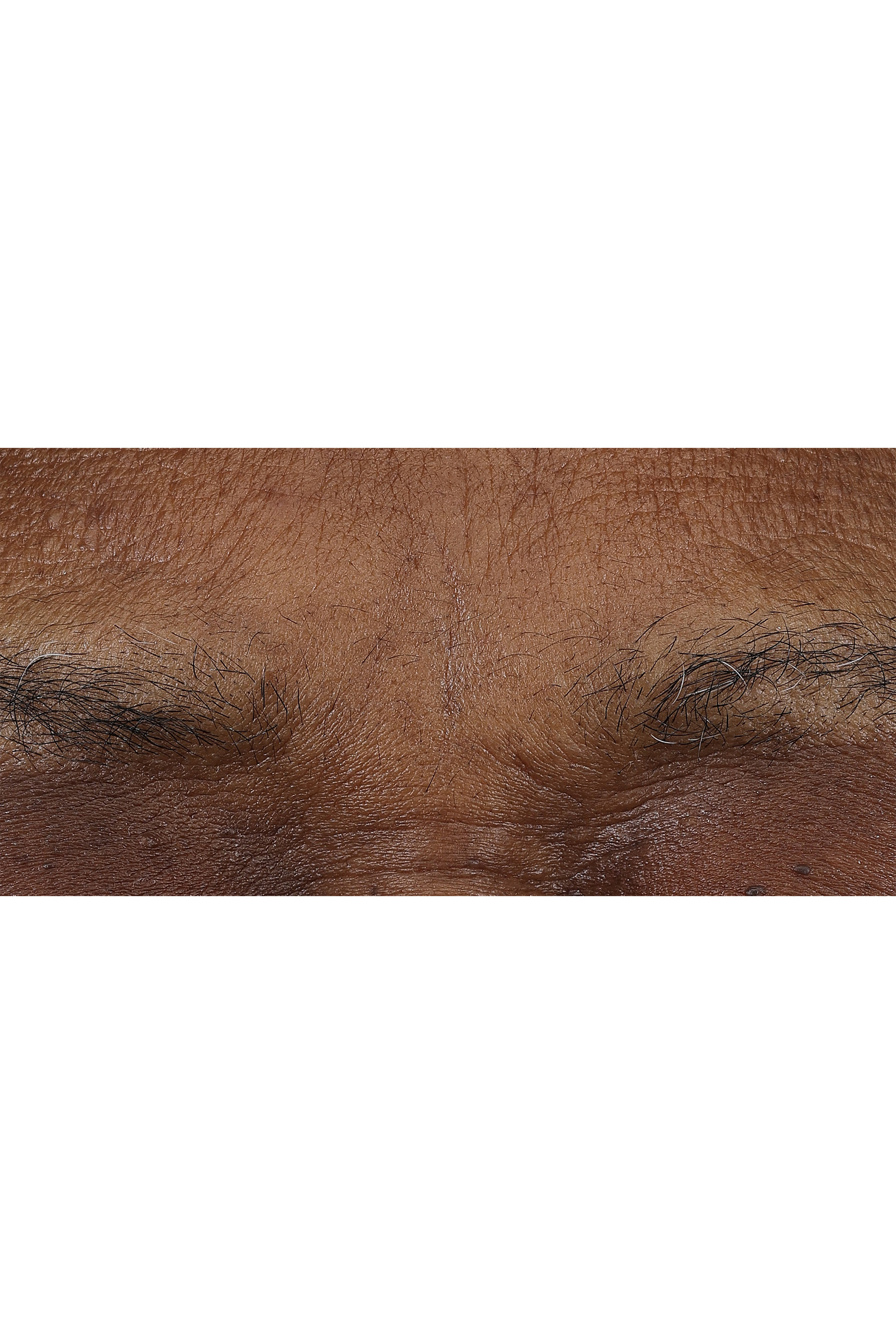 Smart Clinical Repair™ AM/PM Retinoid Balm