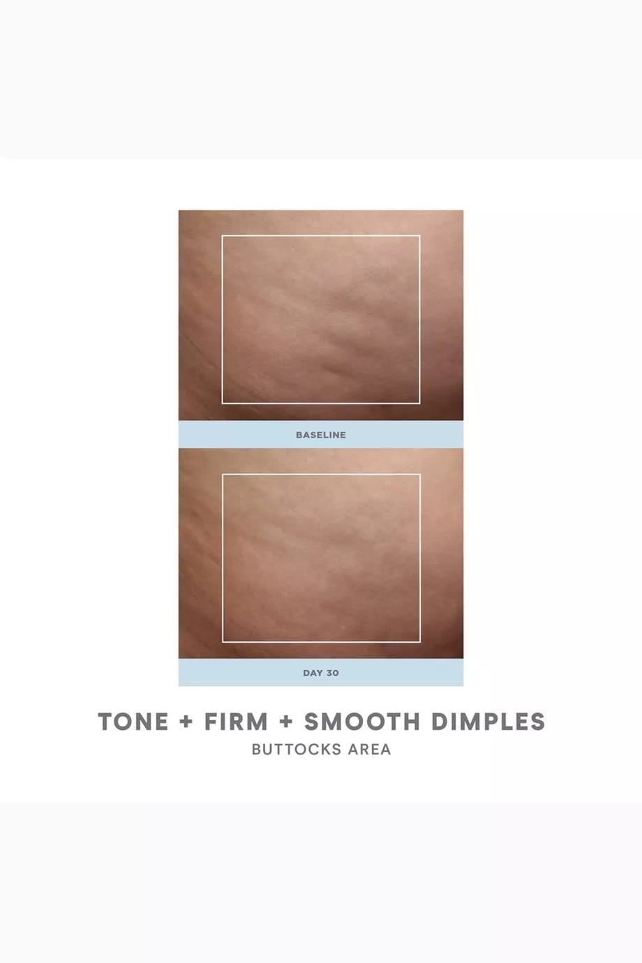 Nubody Skin Toning Device