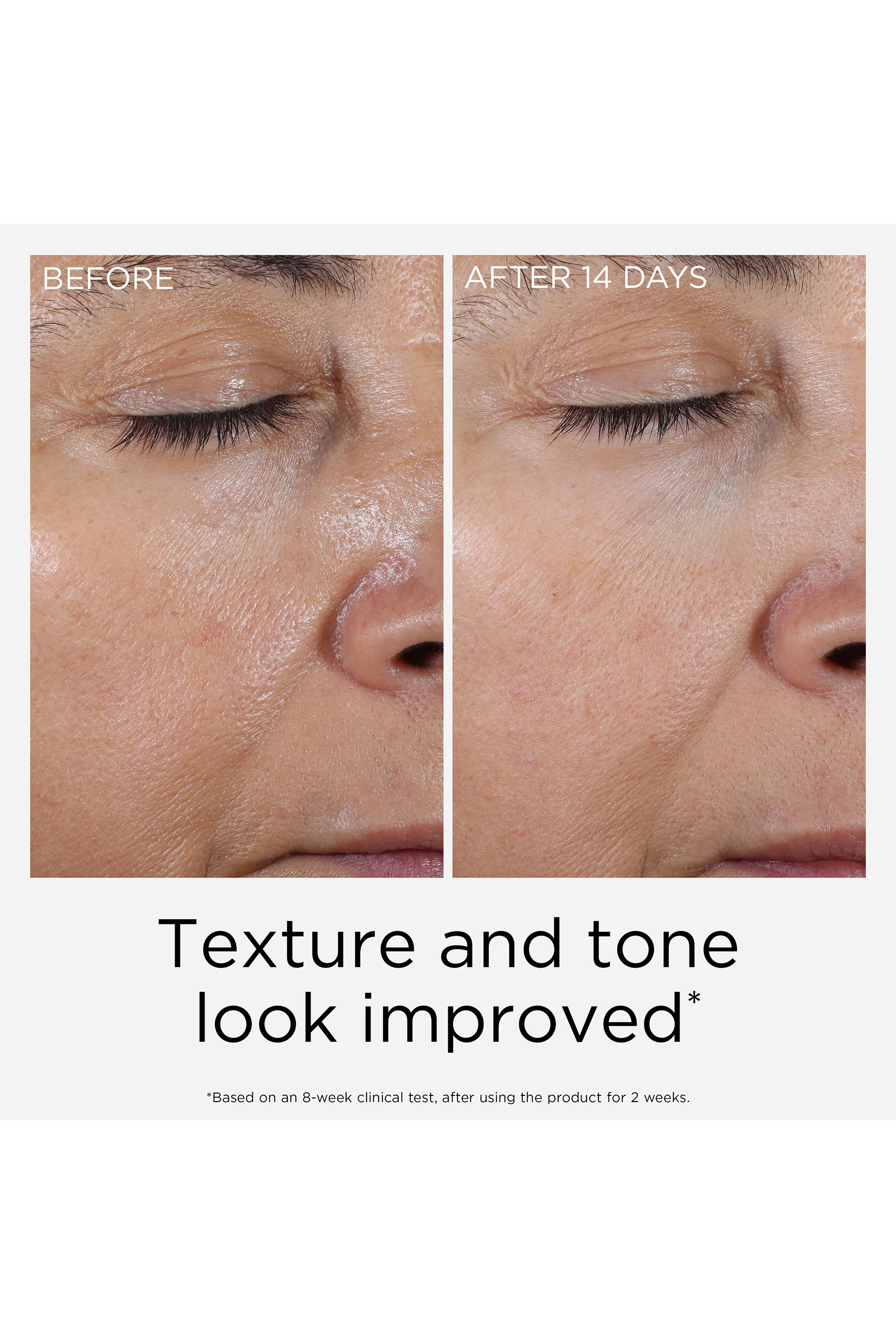 PREVAGE&reg; Anti-Aging Daily Serum 2.0