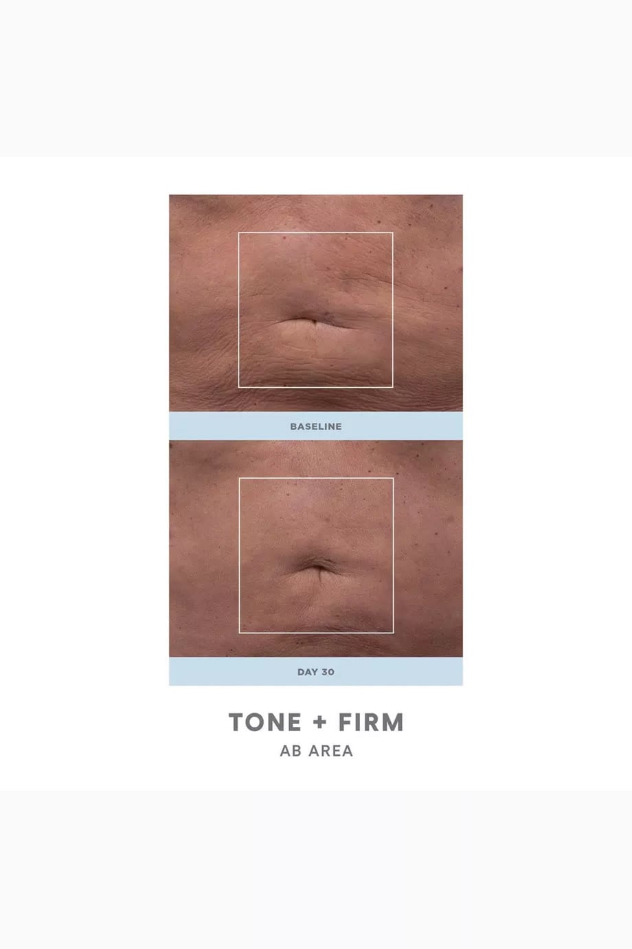 Nubody Skin Toning Device