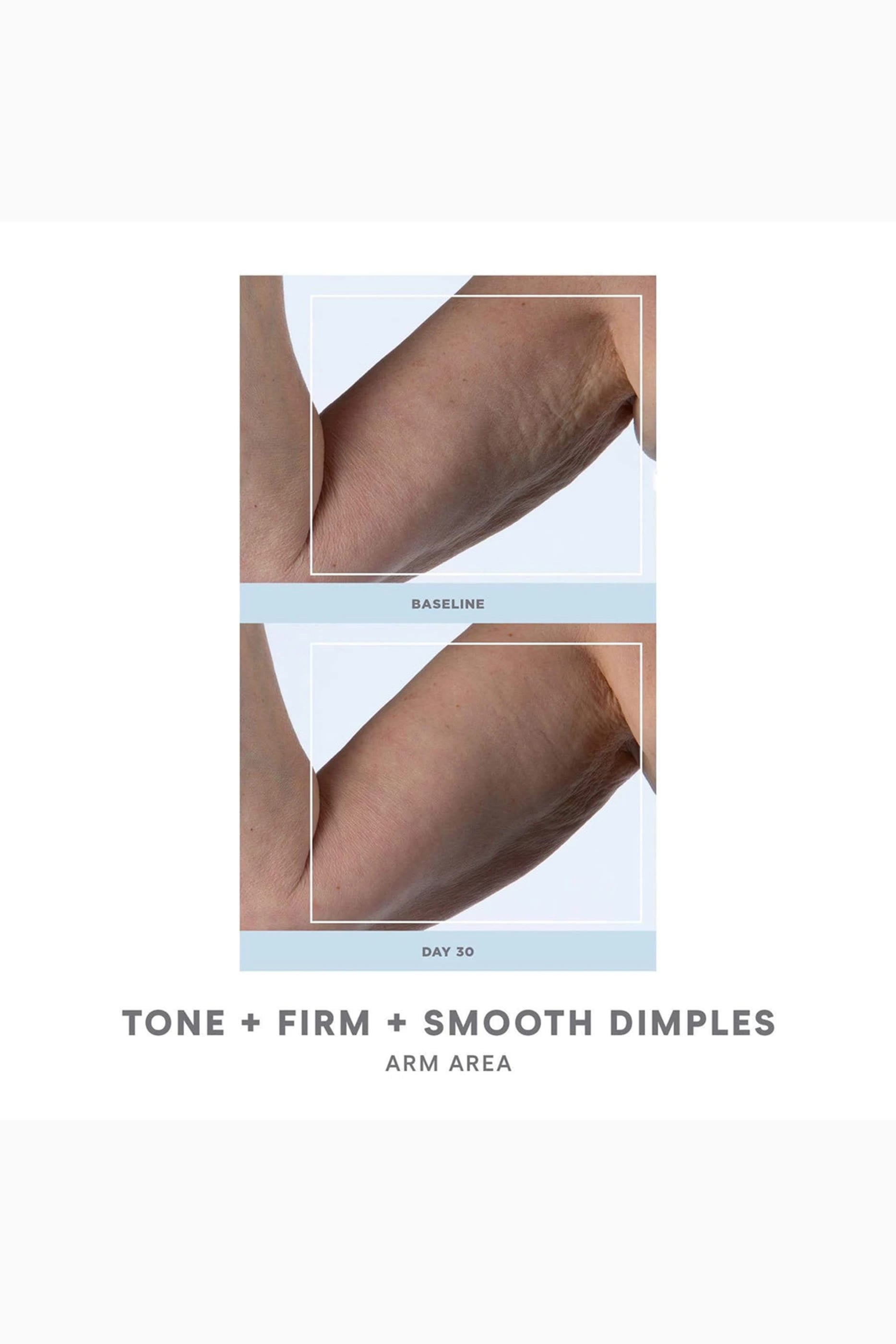 Nubody Skin Toning Device