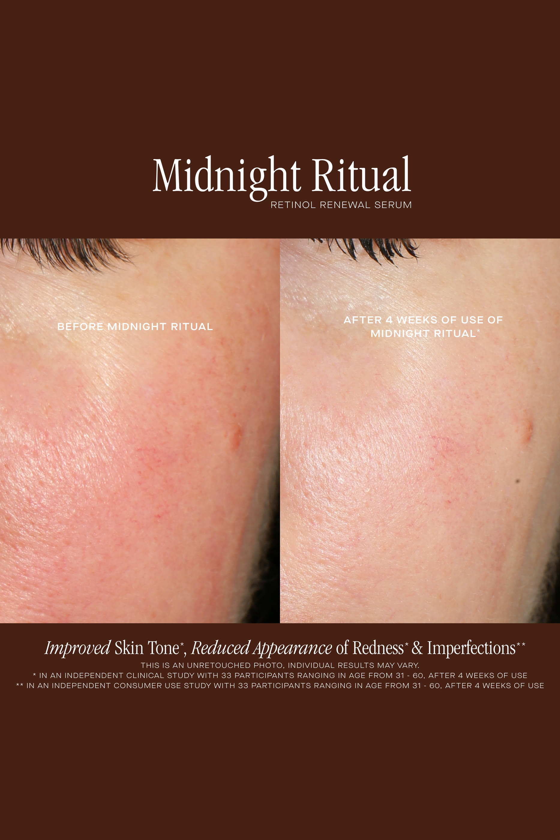 Midnight Ritual Retinol Serum